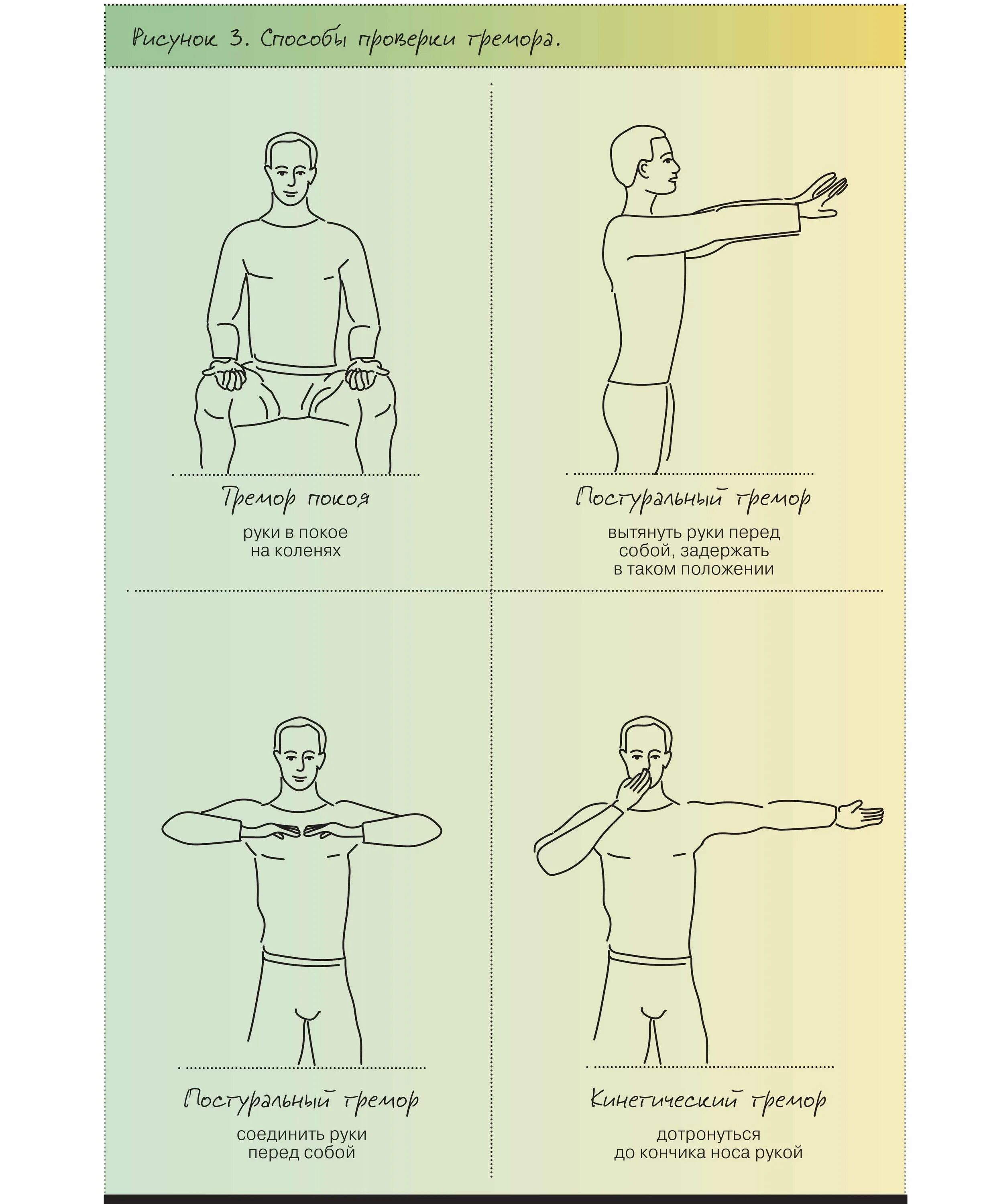 Команды для тряски. Упражнения от дрожания руки. Тремор рук упражнения. Постуральное дрожание. Тремор рук причины.