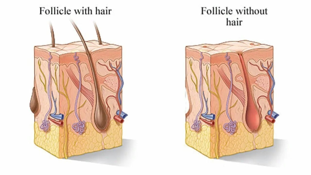 Пробуждение волосяных луковиц. Спящие волосяные луковицы. Волосяная луковица. Спящие волосяные луковицы на голове. Волосяной фолликул.