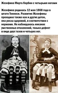 Девушка с 4 ногами