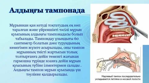 Қызыл кискалар