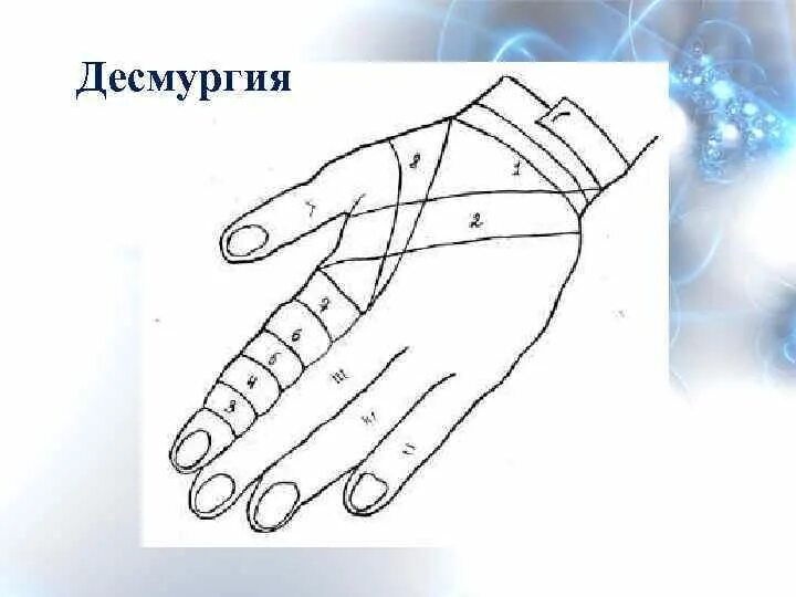 Как перевязать палец на руке. Бинтование безымянного пальца. Бинтовая повязка на указательный палец руки. Техника наложения колосовидной повязки на палец кисти.