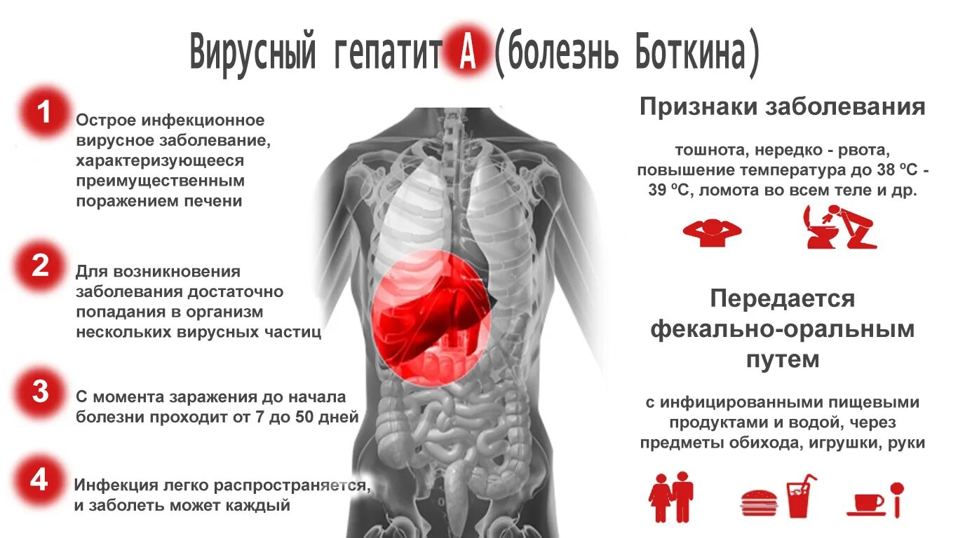 Вирусный гепатит (болезнь Боткина). Вирус гепатита в. Вирусный гепатит симптомы.