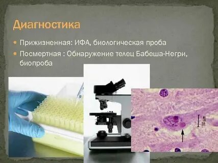 Диагностика бешенства