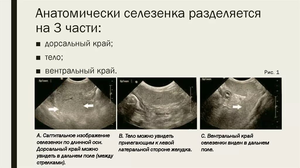 Просто селезенка. Части селезенки. Края селезенки. Назовите части селезенки. Форма селезенки.