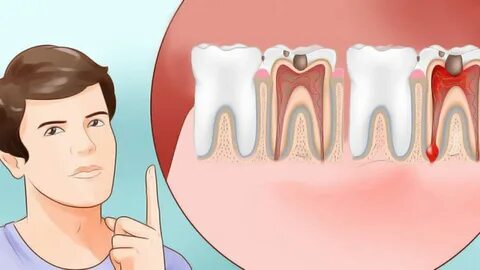 toothache 