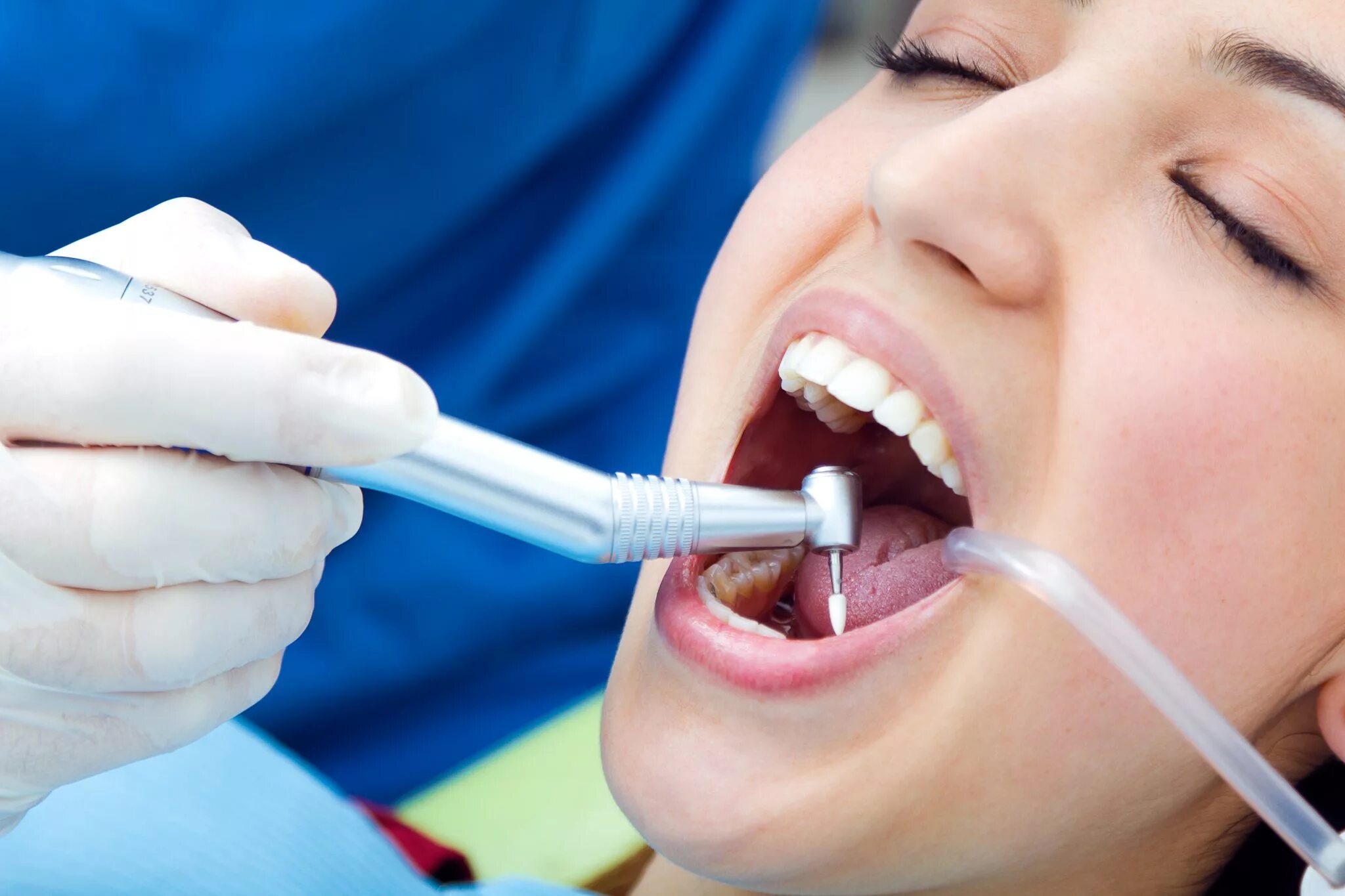 Профессиональная гигиена полости рта. Зубы стоматология.