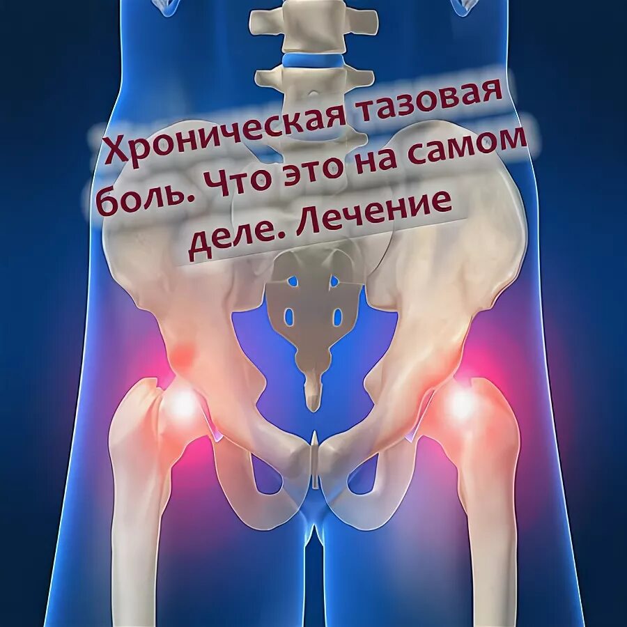 Хроническая тазовая боль у мужчин. Хронический тазовый болевой синдром.