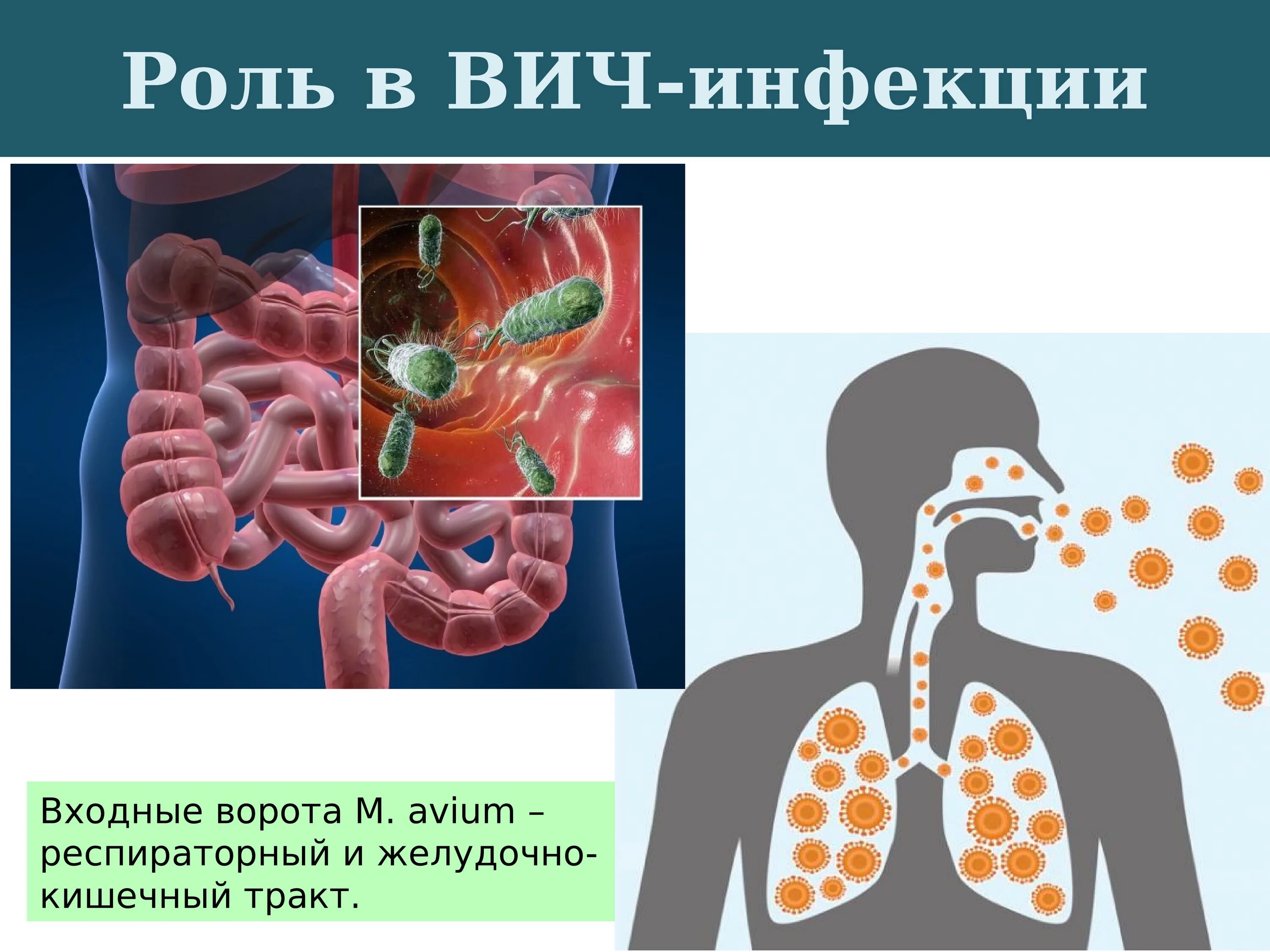 Входные ворота ВИЧ инфекции. Легочный микобактериоз. Входными воротами инфекции. Нетуберкулезный микобактериоз