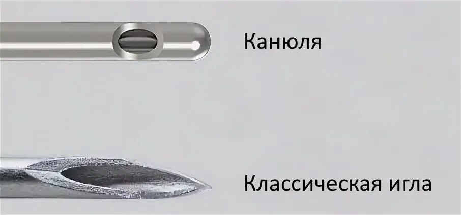 Типы канюль