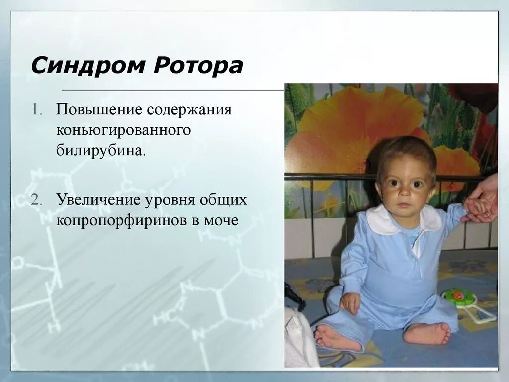 Синдром c. Синдром дабина-джонсона и ротора. синдром ротора симптомы. синдром ротора билирубин. синдром ротора патогенез.