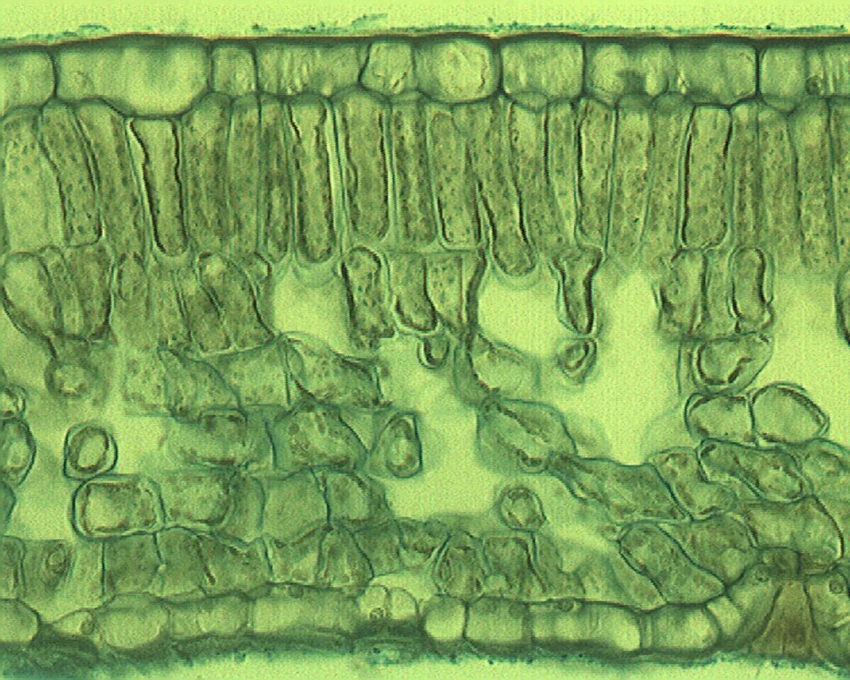 Клетки алоэ. Столбчатый мезофилл листа. Мезофилл листа под микроскопом. Препарат столбчатой ткани листа под микроскопом. Столбчатая ткань листа мезофилл.