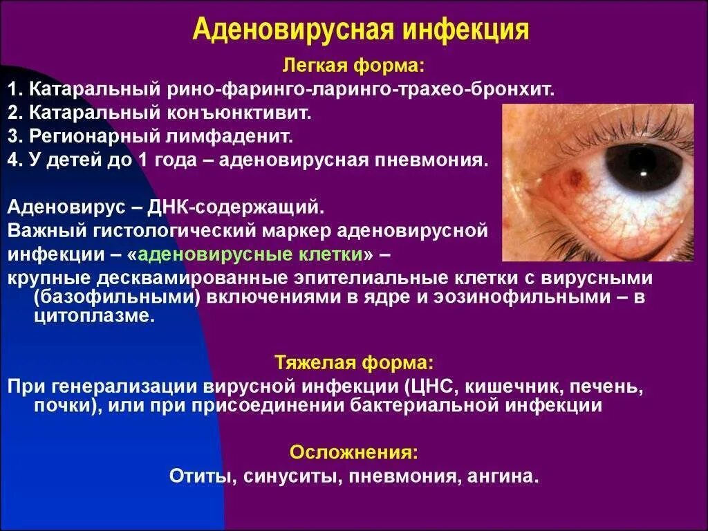Аденовирусная инфекция. Риновирусная инфекция профилактика. Аденовирусная инфекция у детей симптомы. Аденовирус орви. Дифференциальная диагностика гриппа и орви.