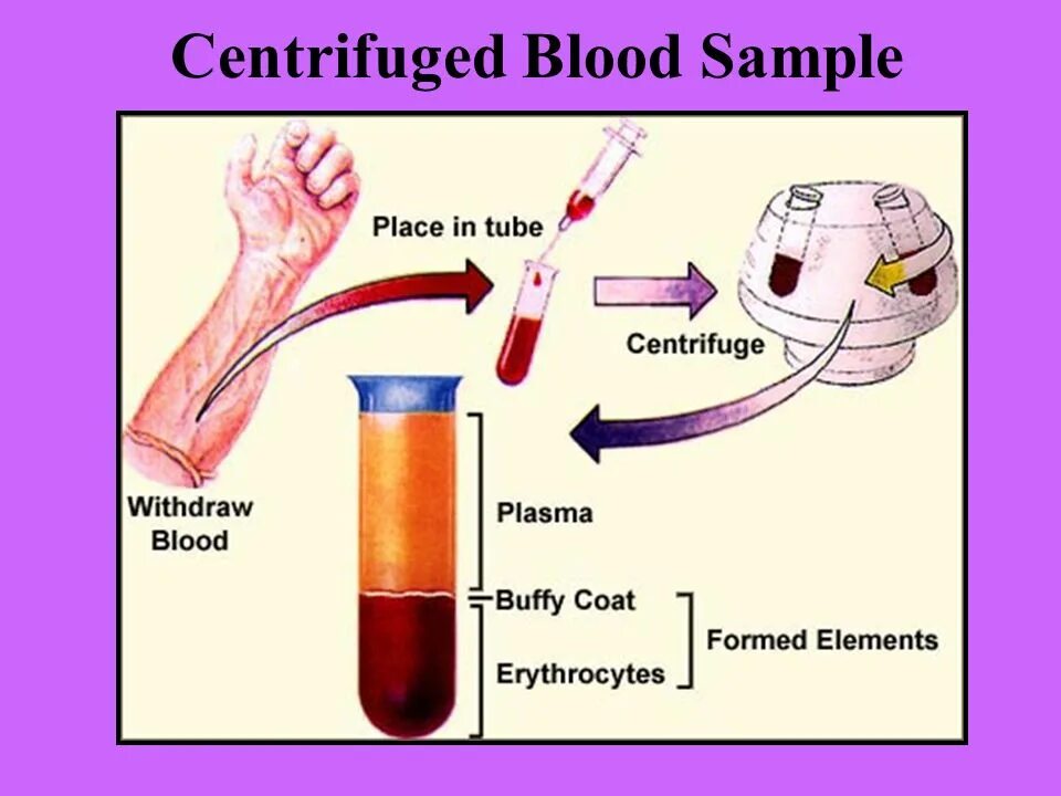 Blood Plasma. Blood Plasma Proteins. Functions of Blood. Plasma? Plasma. Т4 сыворотка крови