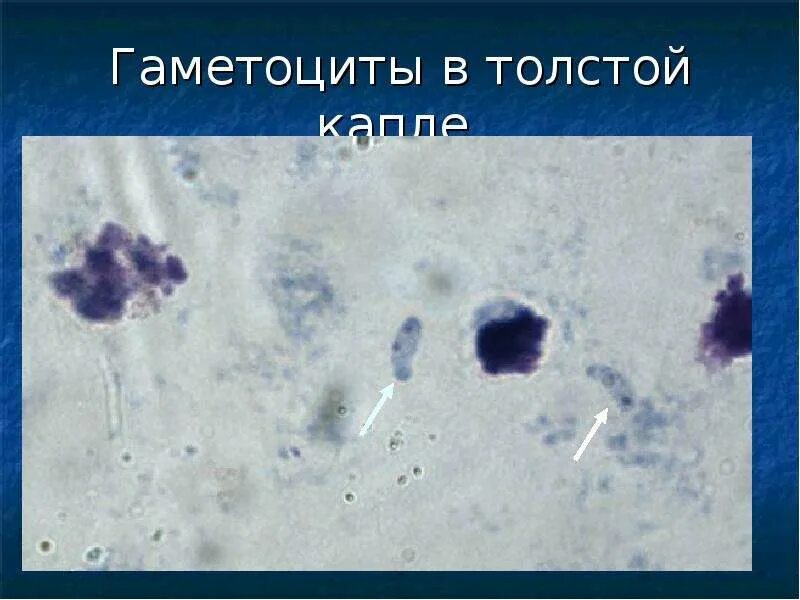 Макрогаметоцит это в паразитологии