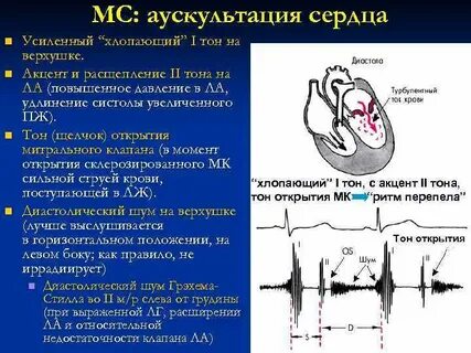 Волчок сердце