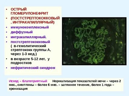 Иммунные комплексы при гломерулонефритах
