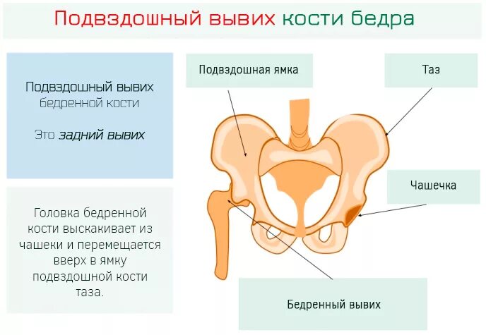 Подвздошная кость гребень. Лонная кость тазобедренного сустава. Дискомфорт лобковой кости. Симфиза лонного сочленения. Дискомфорт лобковой кости.