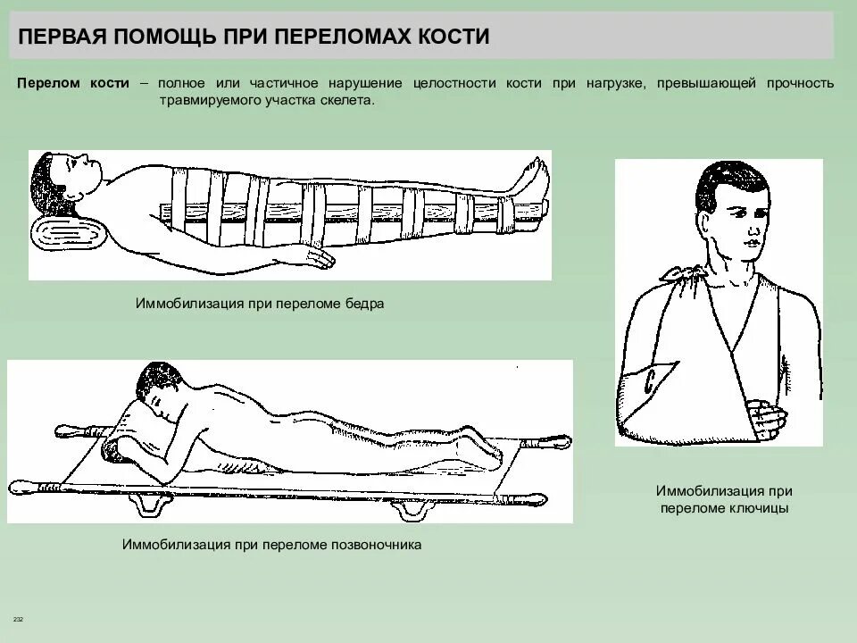 При переломе надо пить. Переломы костей оказание первой помощи. Меры оказания первой помощи при переломах. Первая помощь при переломах костей. Пераая помощь приперелоиах.