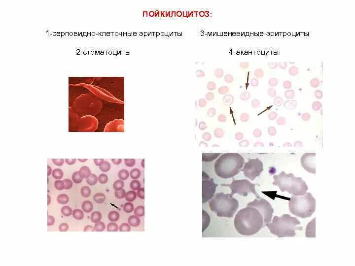 Особенности клеток эритроцитов