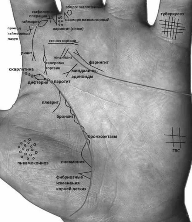 Определить заболевание по рукам. Хиромантия. Хиромантия по руке. Знаки на ладони о болезни. Болезни на ладони хиромантия.