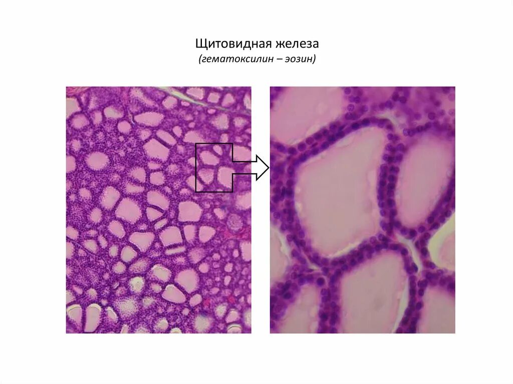 Щитовидная железа микропрепарат гистология. Щитовидная железа гистология гематоксилин эозин. Строение щитовидной железы микропрепарат. Щитовидная железа гистология препарат.