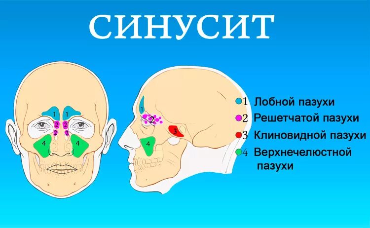 Сморкаюсь с кровью почему