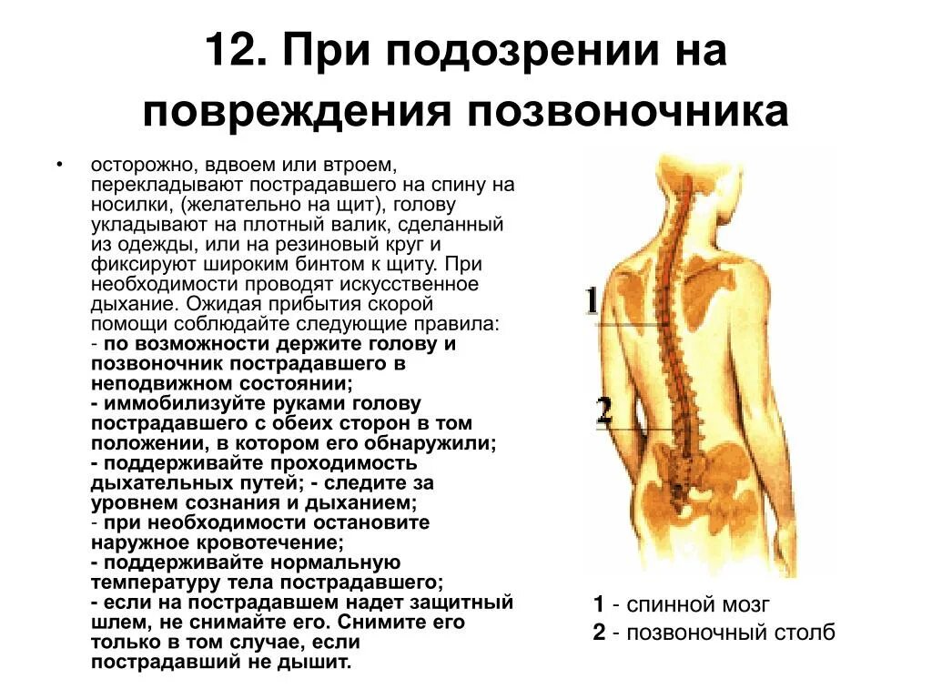 В случае повреждения позвоночника. Повреждений спины позвоночника. Подозрении на травму позвоночника. При подозрении на травму позвоночника необходимо:. Травма спинного мозга первая помощь.