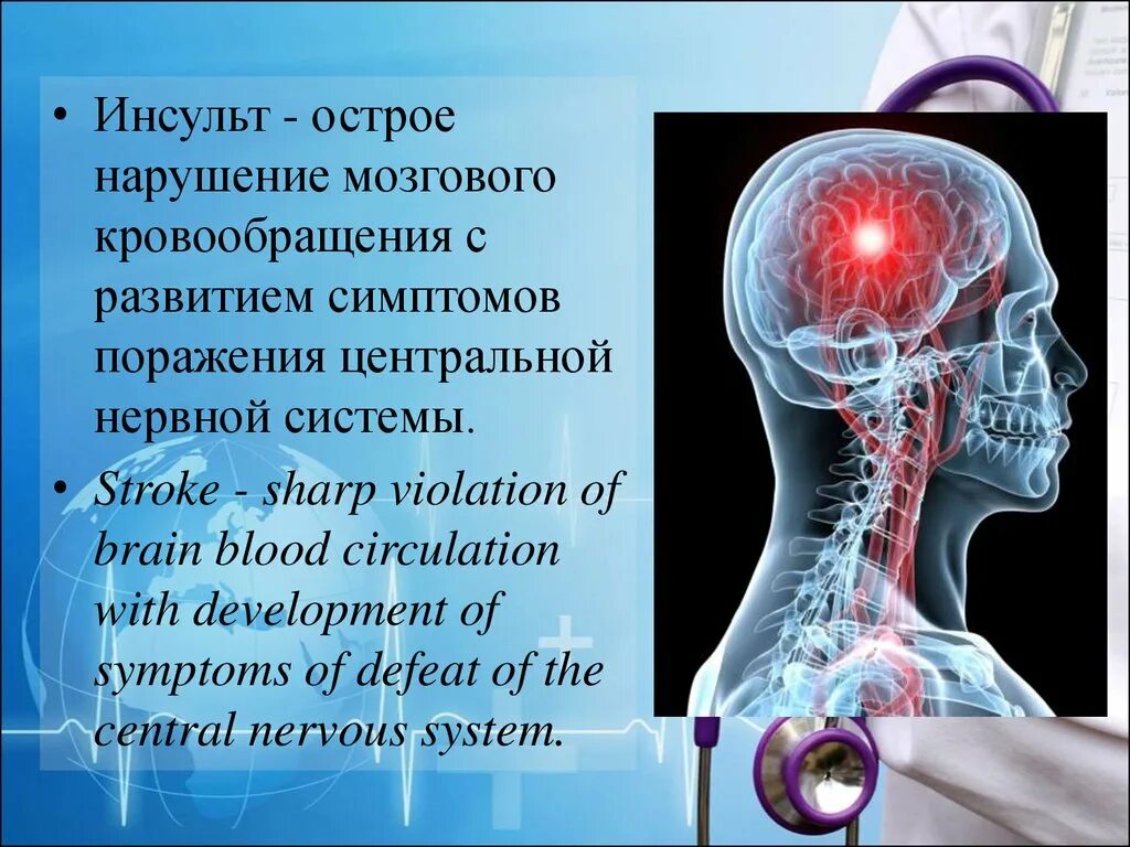 Инсульт острое нарушение мозгового кровообращения. Симптомы инсульта презентация. Острые нарушения кровообращения цнс