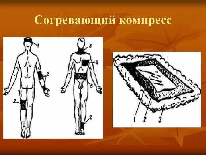 Вторым слоем согревающего компресса является