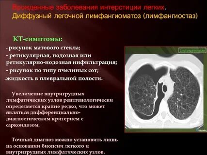 Интерстиций это орган