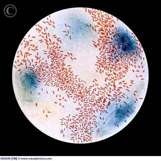 Инфекция вызванная haemophilus