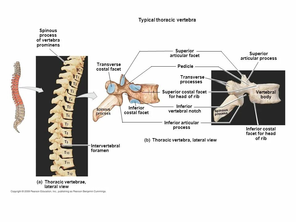 Vertebrae ударение. Анатомия шейных позвонков. Ротатион. Canalis transversalis vertebrae. Vertebrae lumbales dog.