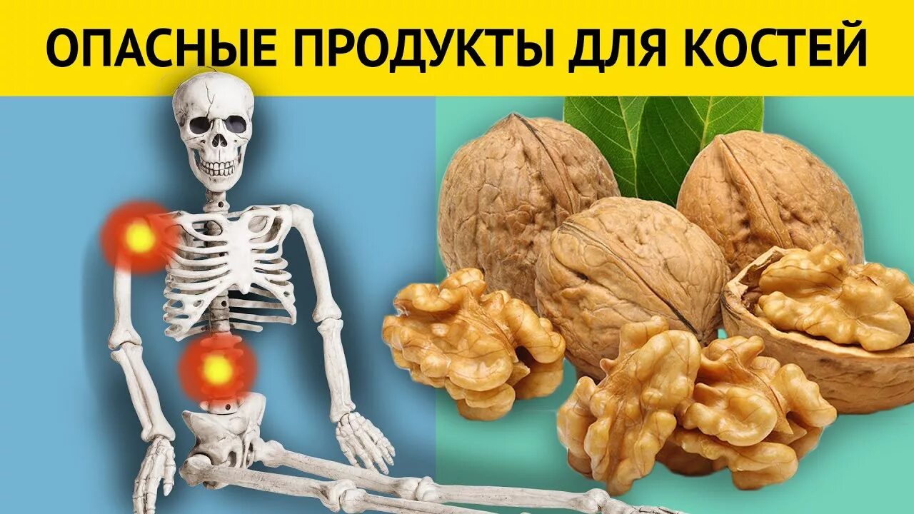 Продукты, опасные для костей. Продукты для крепких костей. Продукты jgfcystдля костей. Продукты, которые разрушают кости. Пища разрушить