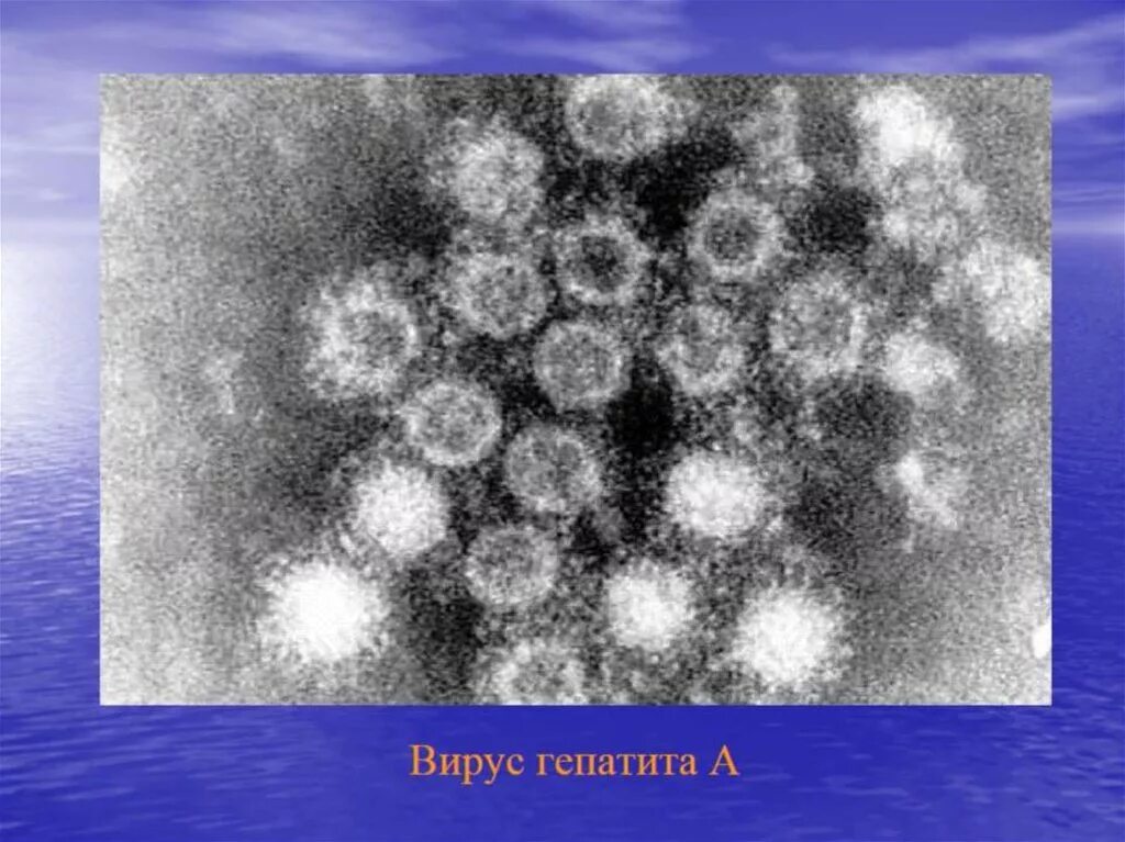 Вирус гепатита 6. Иммунная электронная микроскопия гепатита. Вирус гепатита микрофотография. Гепатит а электронная микроскопия. Вирус гепатита под микроскопом.