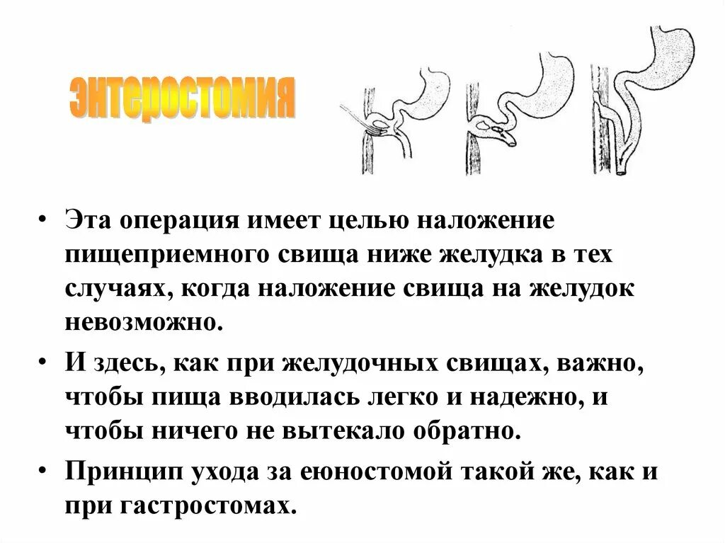 Как правильно пишется свищ. Способы наложения желудочных свищей.