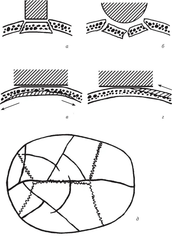 Перелом кости свода черепа. Импрессионный перелом свода черепа. Дырчатый перелом свода черепа. Перелом костей свода черепа. Линейный перелом свода черепа.