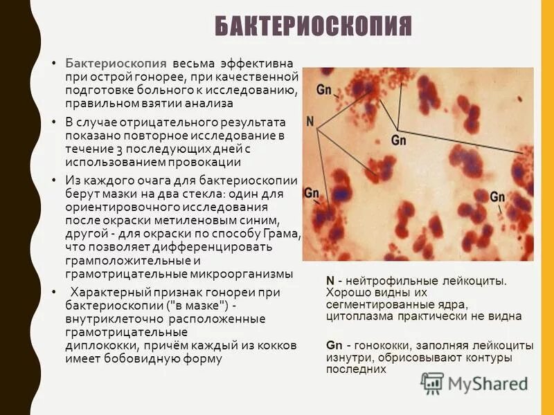 Гонорея способ передачи