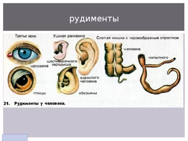 Рудименту атавизмам приведите. Третье веко у человека рудимент. Рудиментарные органы человека. Рудиментарные органы человека примеры.