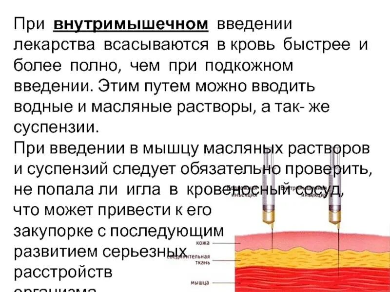 Подкожно вводят лекарственные препараты. Внутримышечное введение лекарственных средств. препараты для внутримышечного введения. внутримышечное и подкожное введение. внутримышечная инъекция.