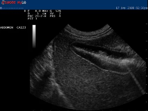 Вакуолизация печени собак УЗИ. УЗИ желчного пузыря с нагрузкой. Есть ли у собак желчный пузырь.