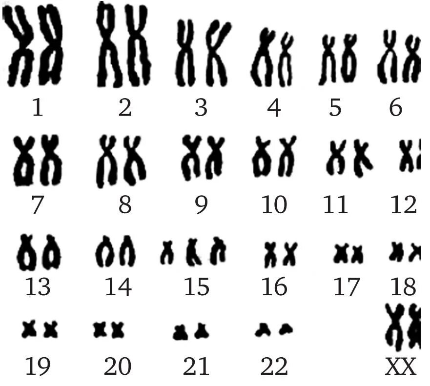 Кариотип 46 хромосом. 46 ХХ нормальный женский кариотип. Кариотип человека хромосомы. Кариограмма хромосом мужчины.