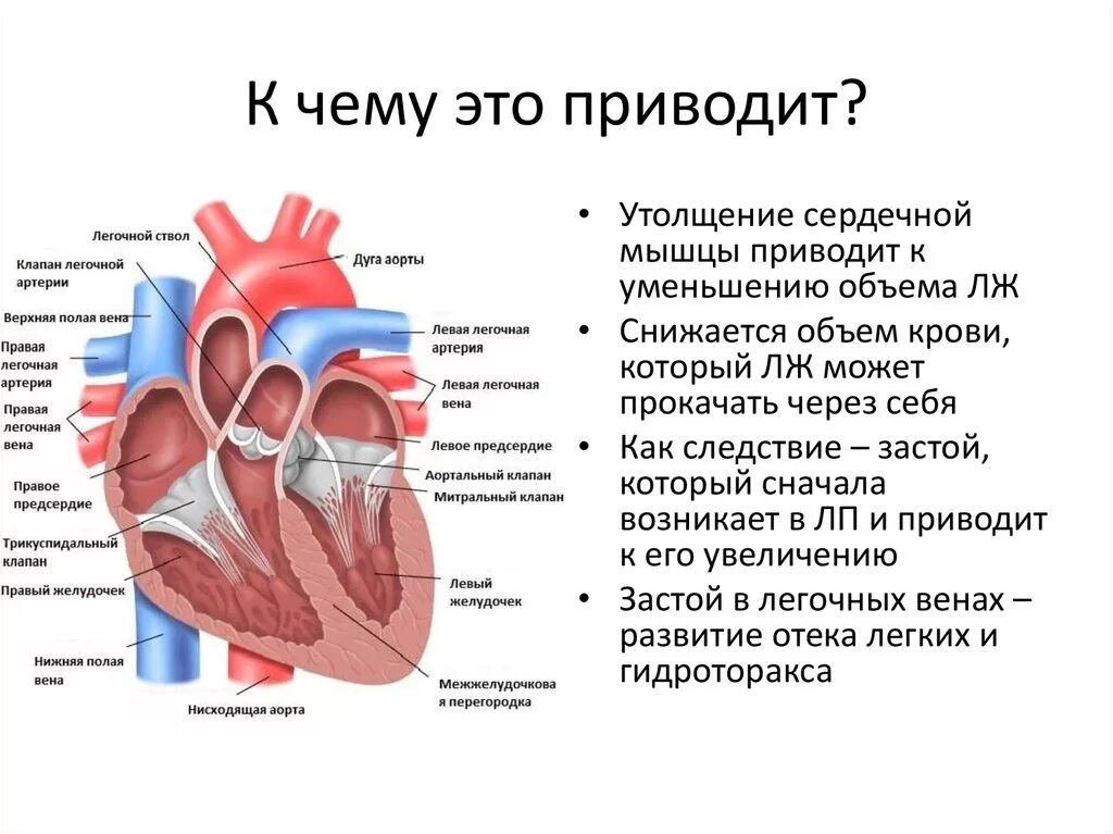 Клапан легочной артерии функция. Клапан легочной артерии диаметр 20мм. Легочный ствол правая легочная артерия. Клапан легочного ствола функции. От левого предсердия к легким