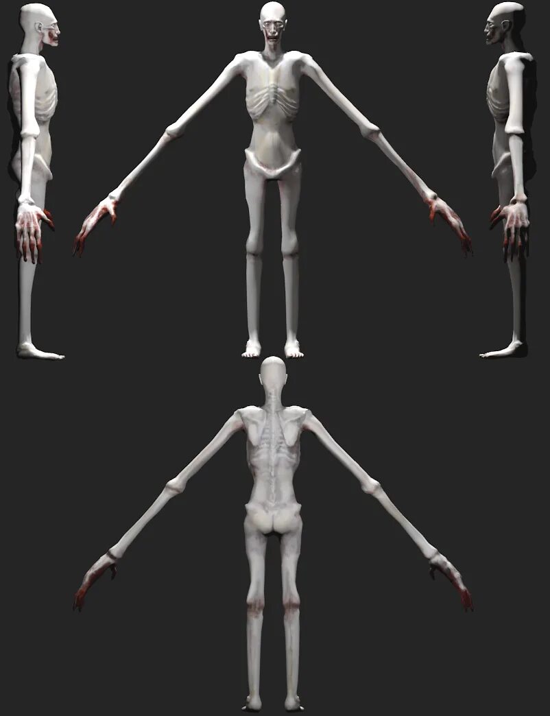 Ссп 096. Ссп 096. Scp 096 лицо реальная жизнь. Ссп 096. Ссп 096.