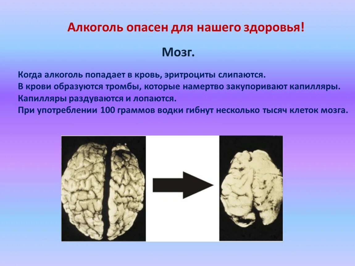 Опасно есть мозги. Алкоголь опасен для здоровья.