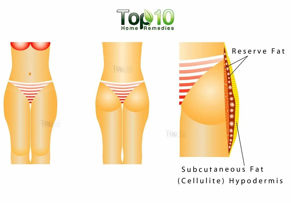 Thigh hip разница. Виды ляшек. Thighs Hips различия. Как называется просвет между бедрами у женщины.