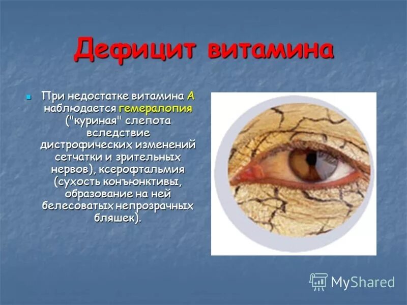 Заболевание куриная слепота витамины. Недостаток витамина в6 симптомы. При недостатке витамина в6. Дефицит витамина в6. Витамин б6 при недостатке.