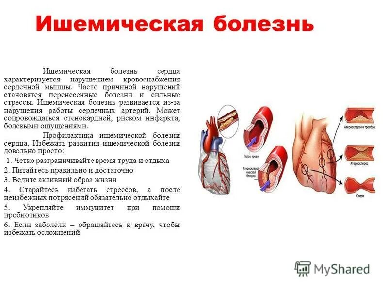 сердечнососудистая состема человек. нарушений кровоснабжения сердца. нарушений кровоснабжения сердца. плохое кровообращение фото. сердце и кровеносные сосуды.