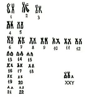 Денверская классификация