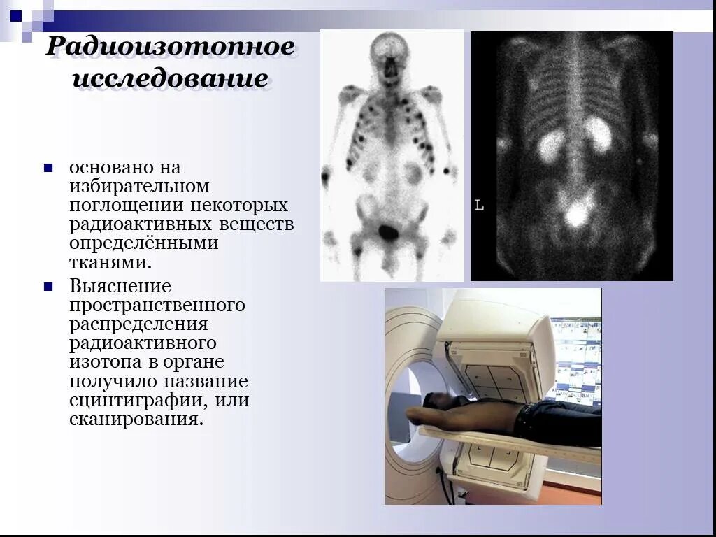 Исследование изотопами. Радиоизотопное исследование. Радиоизотопные методы диагностики. Радиоизотопное исследование почек. Радиоизотопные методы обследования пациентов.