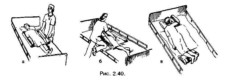 Перемещение пациента с гемиплегией в положение на животе. Укладывание пациента на живот. Укладывание пациента на живот алгоритм. Перемещение больного в постели алгоритм.